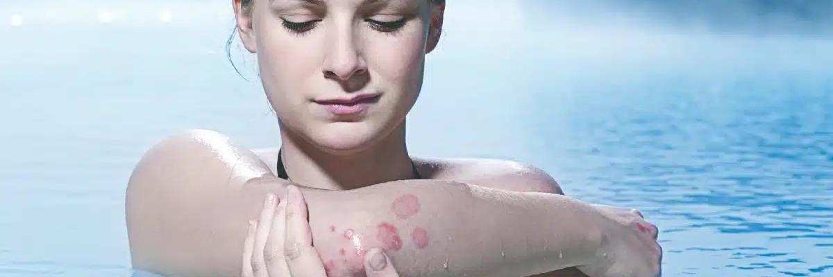 Blue Lagoon Skin Care